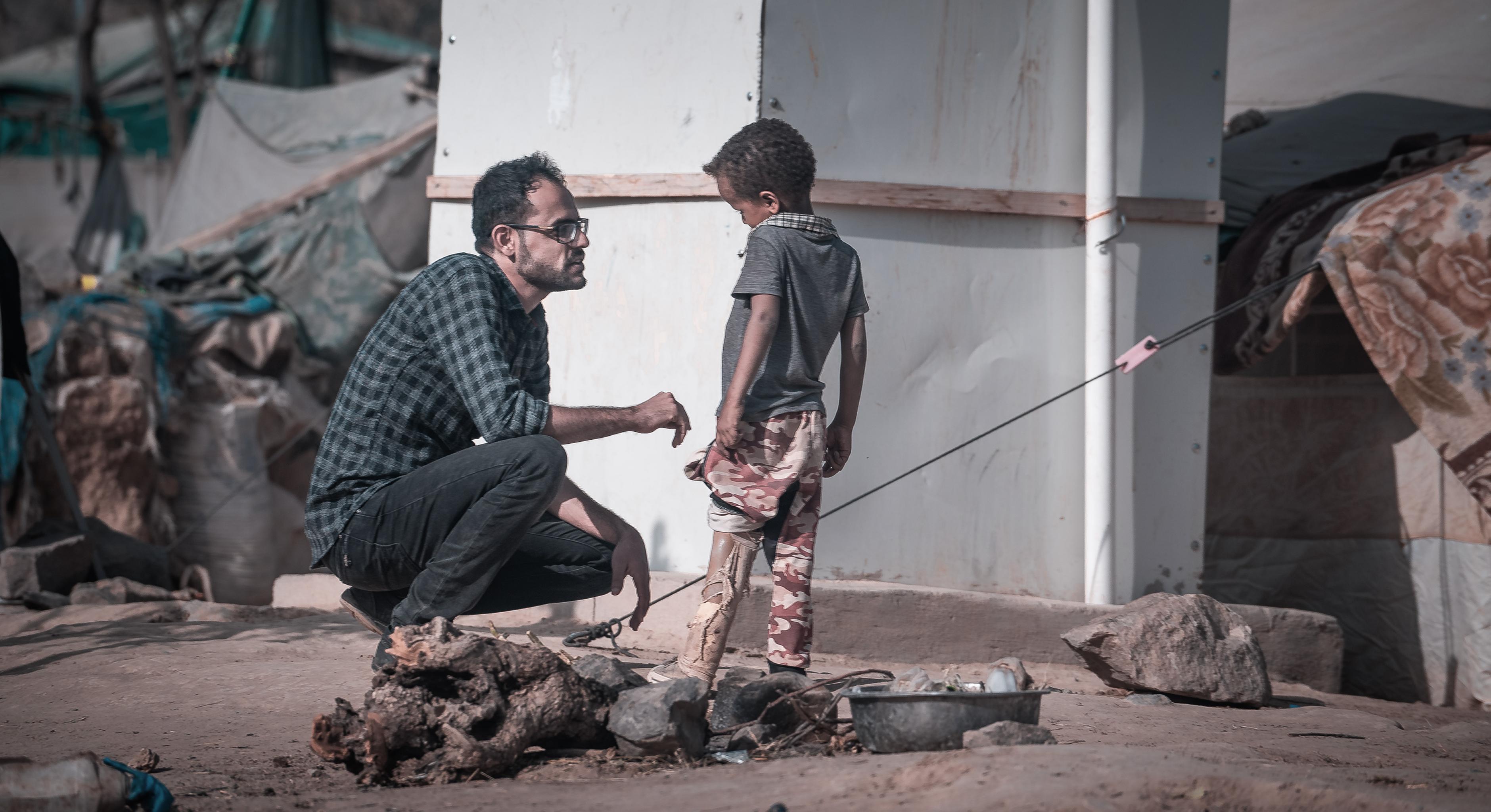 Ein Junge aus dem Jemen mit einer Beinprothese