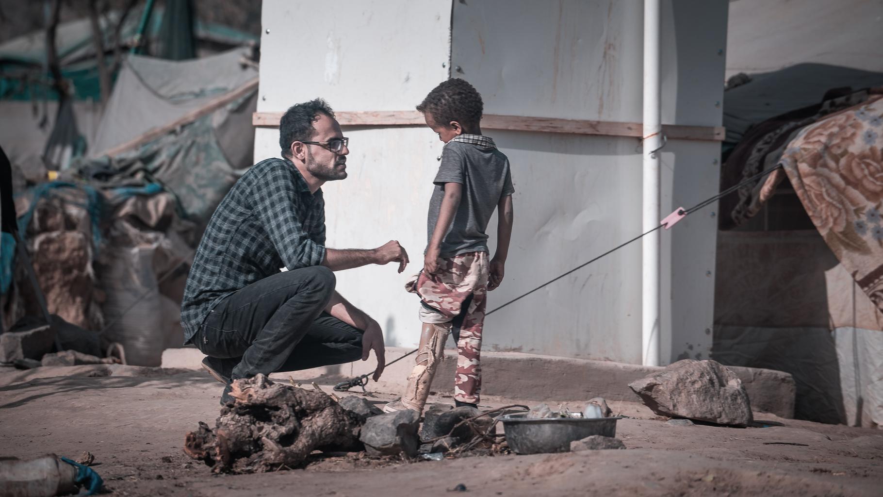 Ein Junge aus dem Jemen mit einer Beinprothese